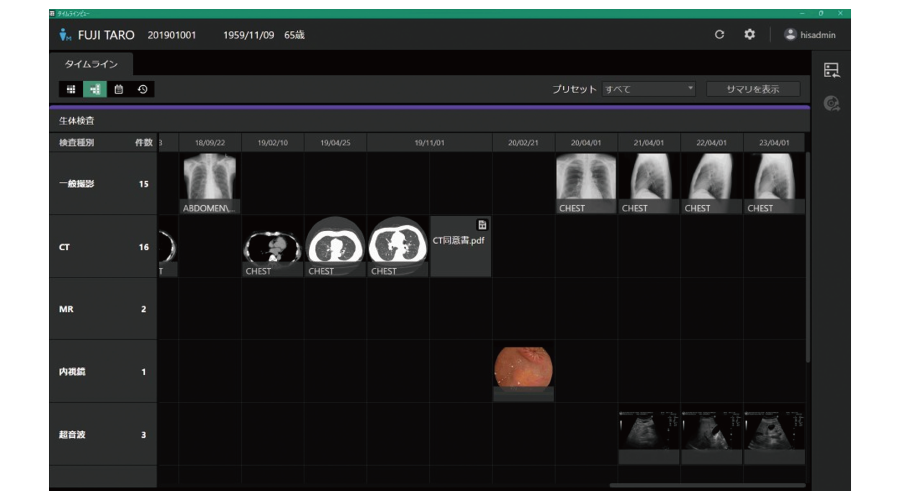 タイムラインビューを表した画像