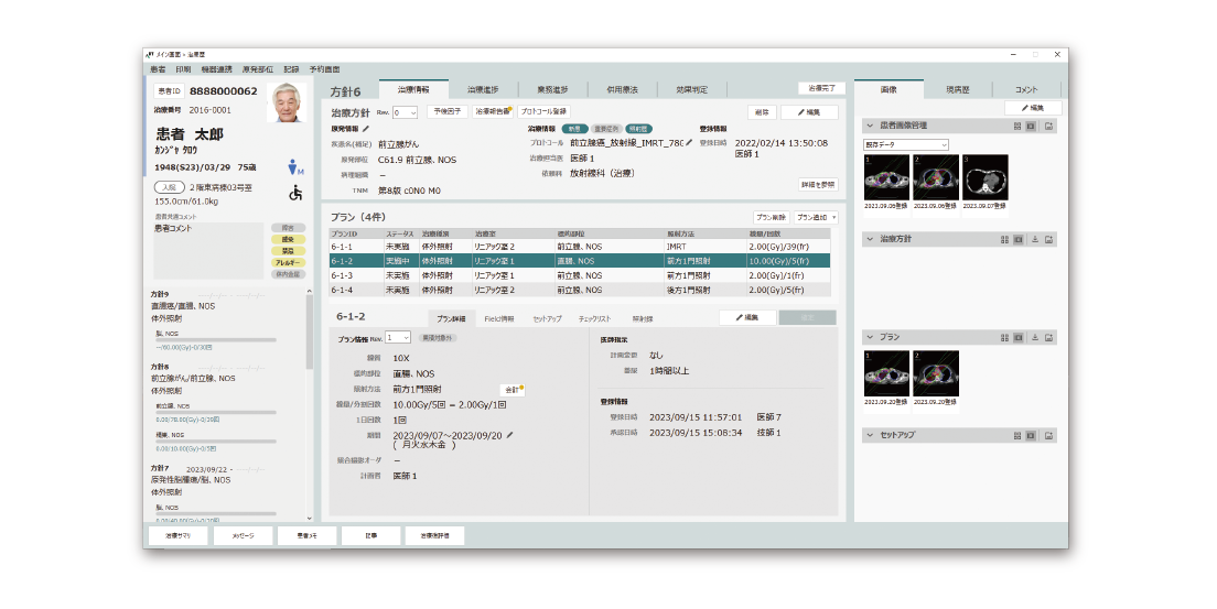 患者の治療に関する情報をサマライズした放射線治療部門システムのメイン画面