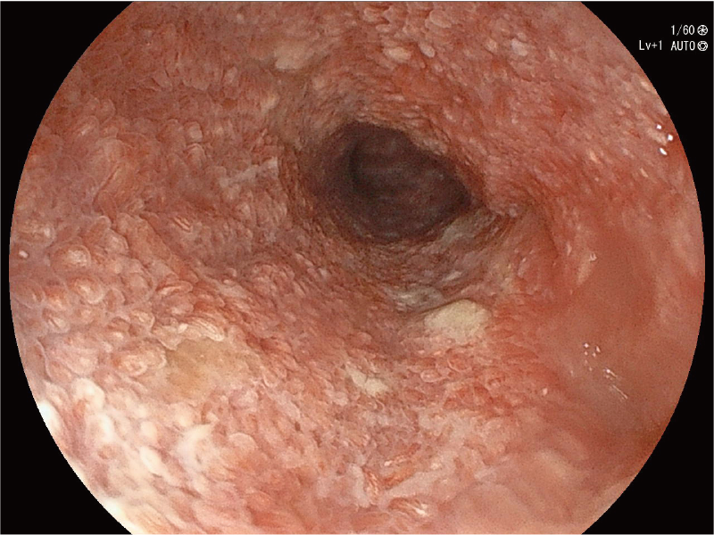 ファイリングシステムやPACSへSXGAの解像度で保存した画像