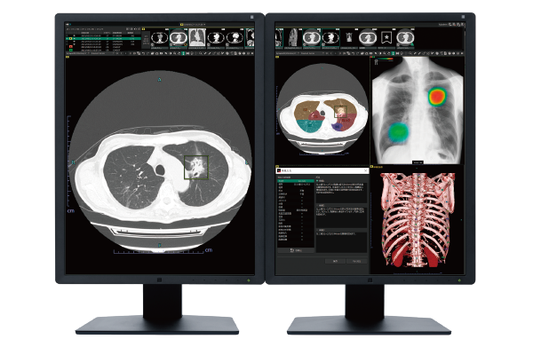 SYNAPSE SAI Viewerのビューワイメージ画像