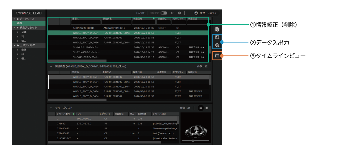 ワークリストを表した画像