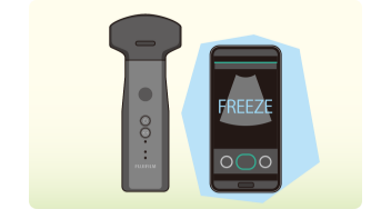 iViz air コンベックス:サポート | 富士フイルム [日本]