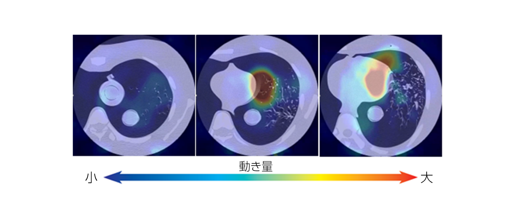 動態ファントムによる動きベクトル量表示の画像​