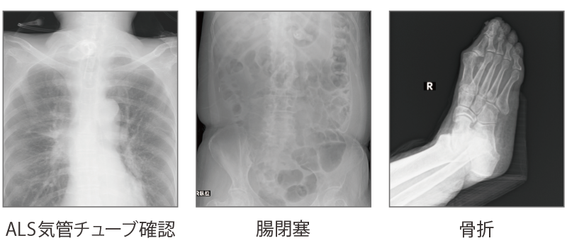 ダイナミック処理参考画像