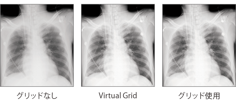 グリッド画像の比較