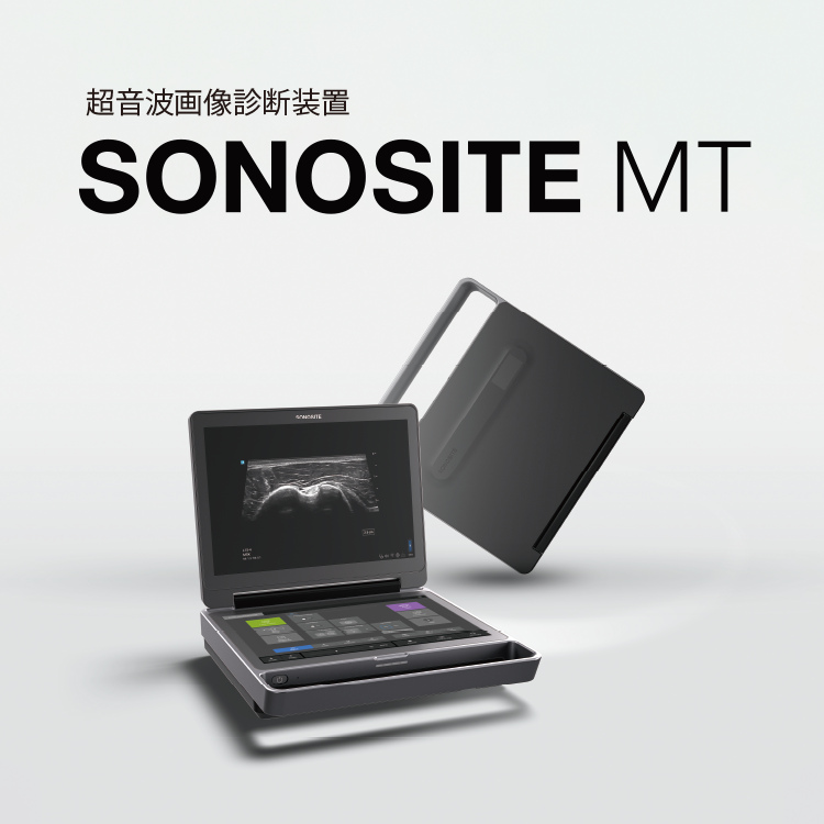 超音波画像診断装置 Sonosite MT | 富士フイルム [日本]