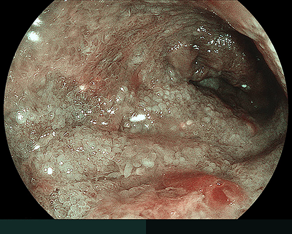 内視鏡症例画像