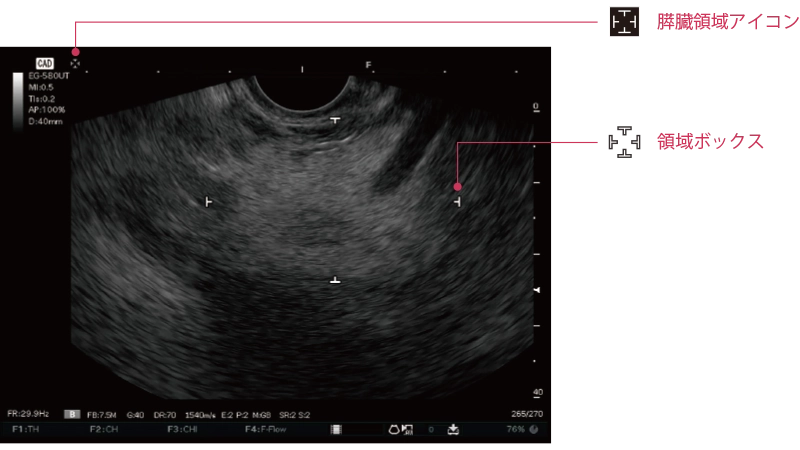 膵臓が存在すると推定される領域を検出した超音波内視鏡画像​​