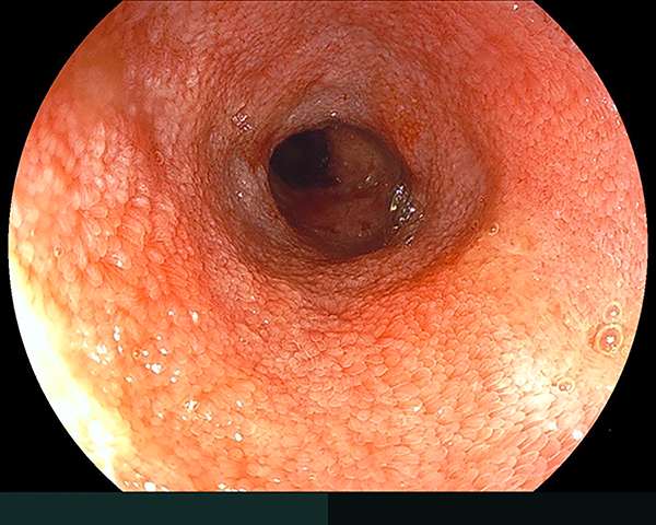 内視鏡症例画像