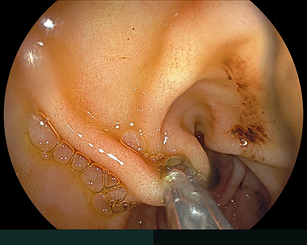 内視鏡症例画像