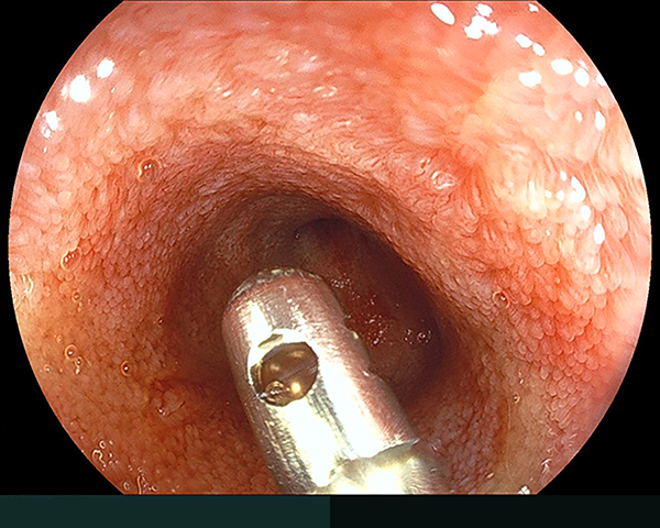 内視鏡症例画像