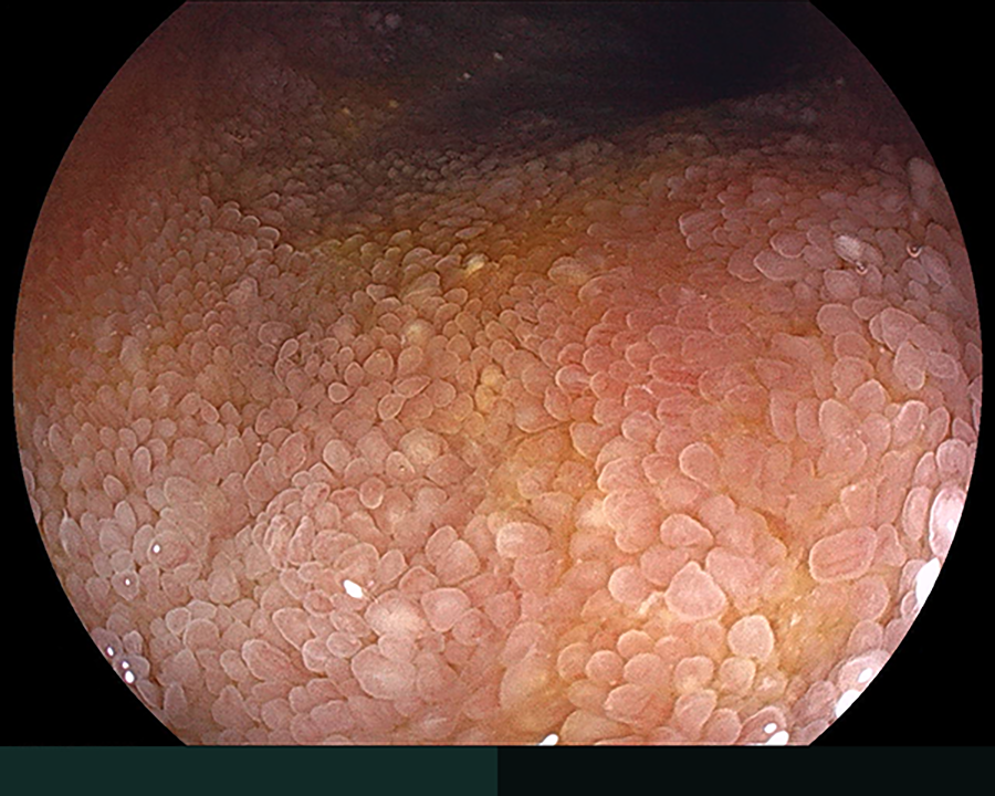 内視鏡症例画像