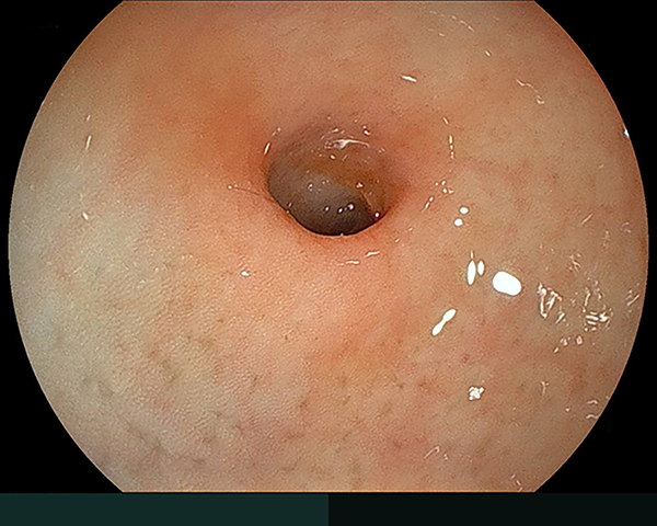 内視鏡症例画像