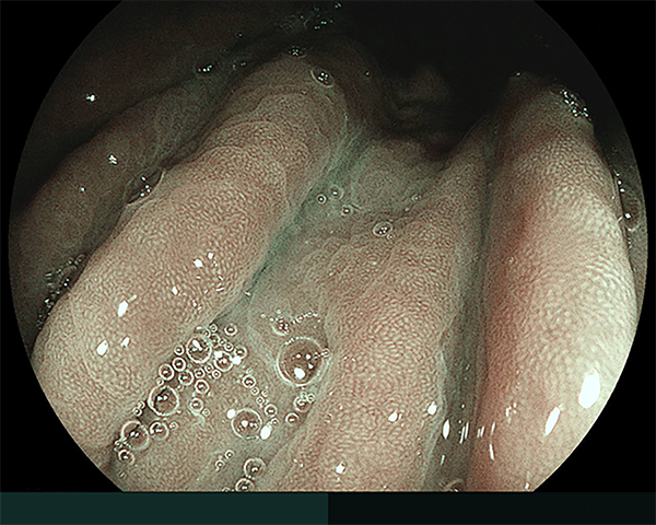 内視鏡症例画像