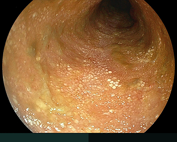 内視鏡症例画像