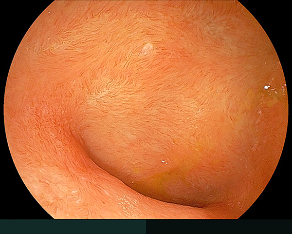 内視鏡症例画像