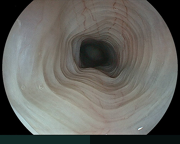 内視鏡症例画像