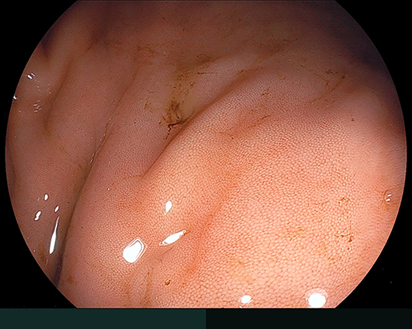 内視鏡症例画像