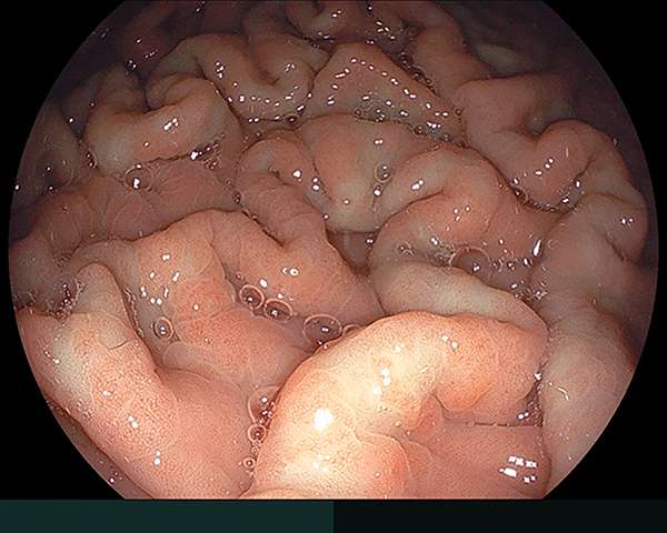 内視鏡症例画像