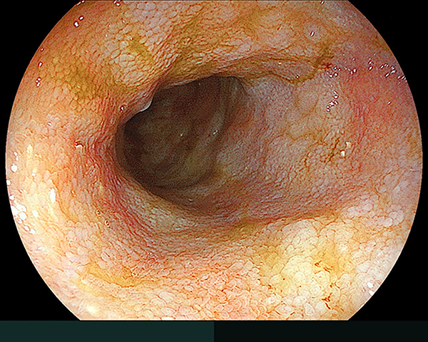 内視鏡症例画像