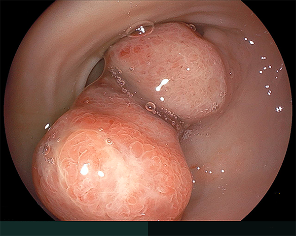 内視鏡症例画像
