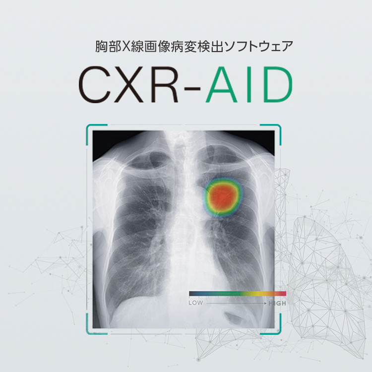 医療AI] 胸部X線画像病変検出ソフトウェア CXR-AID | 富士フイルム [日本]
