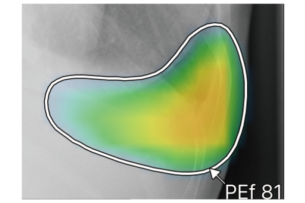 ヒートマップと輪郭を表示する場合のイメージ図