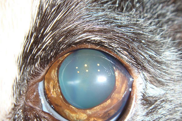 虹彩メラノーシス