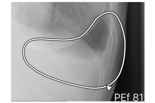 輪郭のみを表示する場合のイメージ図