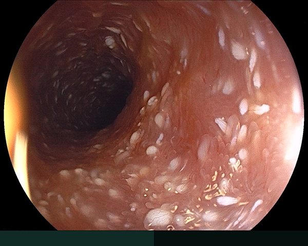 内視鏡症例画像