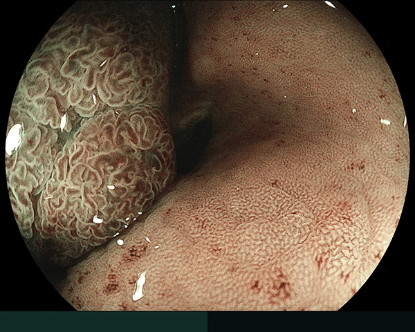 内視鏡症例画像