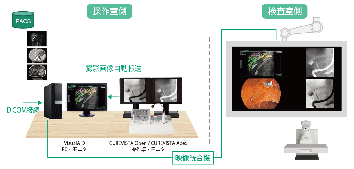 ERCPプランニングの運用例を示した図​