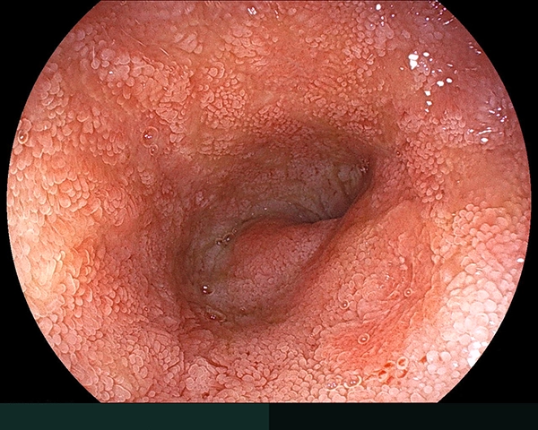 内視鏡症例画像
