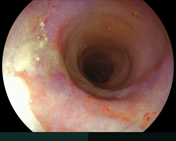内視鏡症例画像