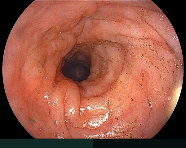 内視鏡症例画像
