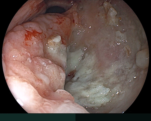 内視鏡症例画像