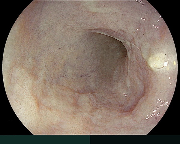 内視鏡症例画像