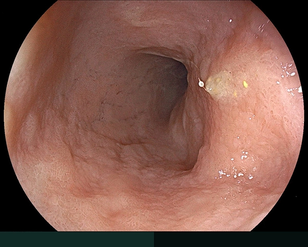 内視鏡症例画像