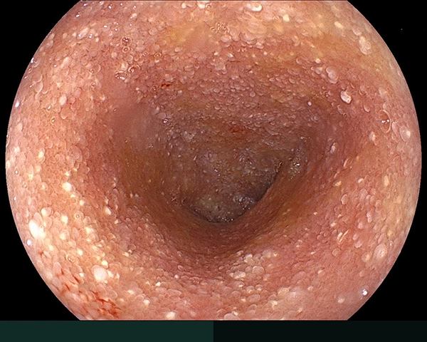 内視鏡症例画像