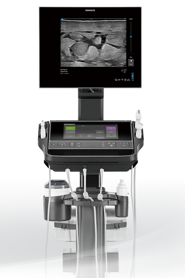 SonositeLX正面画像