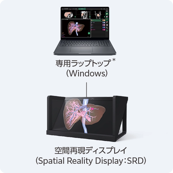 3D画像解析システム SYNAPSE VINCENT | 富士フイルム [日本]