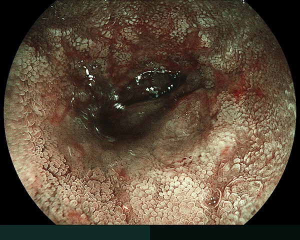 内視鏡症例画像
