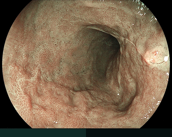 内視鏡症例画像