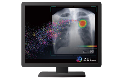 CXR-AID処理実施時の表示画面例