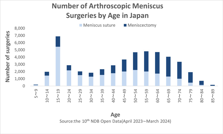 Graph Showing Number of Arthroscopic Meniscus Sugeries by Age in Japan