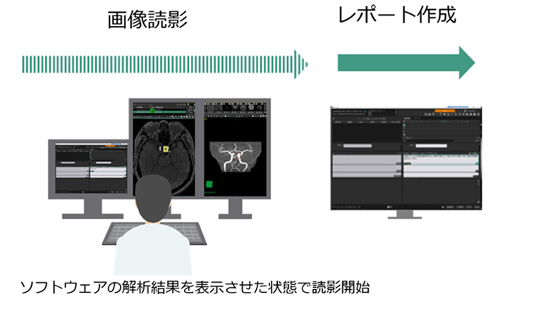 医師がコンカレントリード型のソフトウェアによる解析結果を用いて読影を行う様子