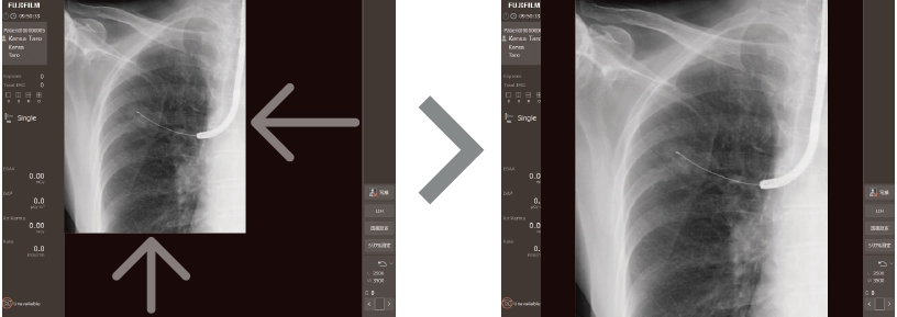 IntelliSHUTTERの概念図​