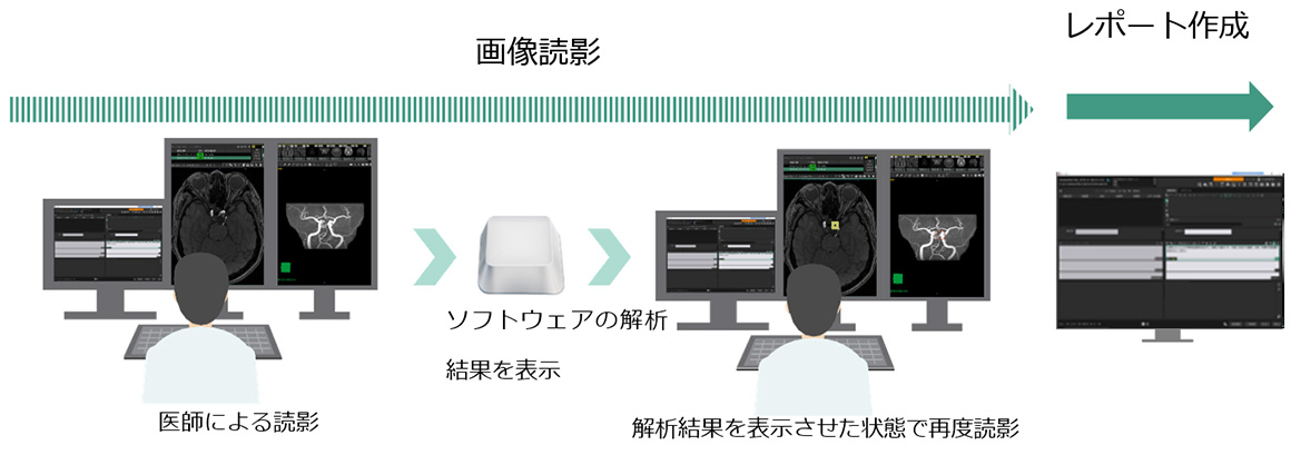 医師がセカンドリード型のソフトウェアによる解析結果を用いて読影を行う様子