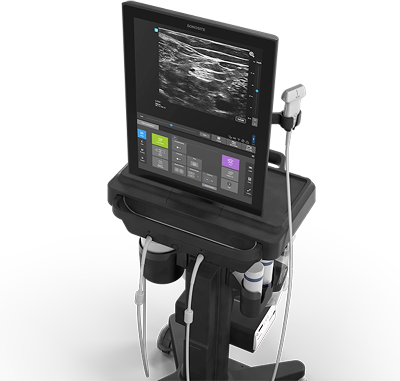 Sonosite STは全画面タッチスクリーンで直感操作が可能