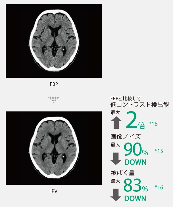IPV機能のメリットを示した図
